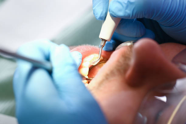 Best Weekend Emergency Dentist in Garden City South, NY