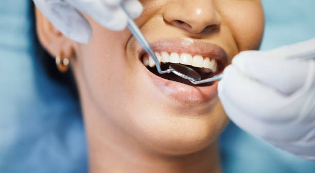 Best Emergency Tooth Extraction in Garden City South, NY